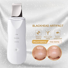 Load image into Gallery viewer, Ultrasonic Face Massager Ion Deep Cleaning Skin Microcurrent Scrubber Shovel Facial Pore Blackhead Cleaner Beauty Tools